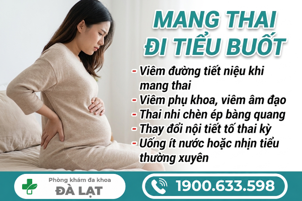 Hình ảnh minh họa